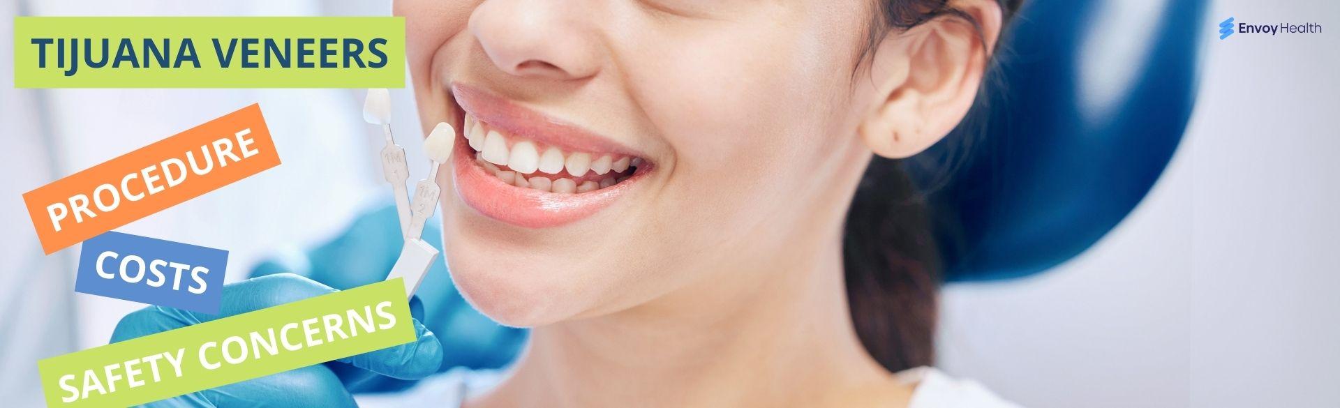 Tijuana Veneers: Know the Costs, Procedure, and Safety Concerns Tijuana Veneers: Know the Costs, Procedure, and Safety Concerns