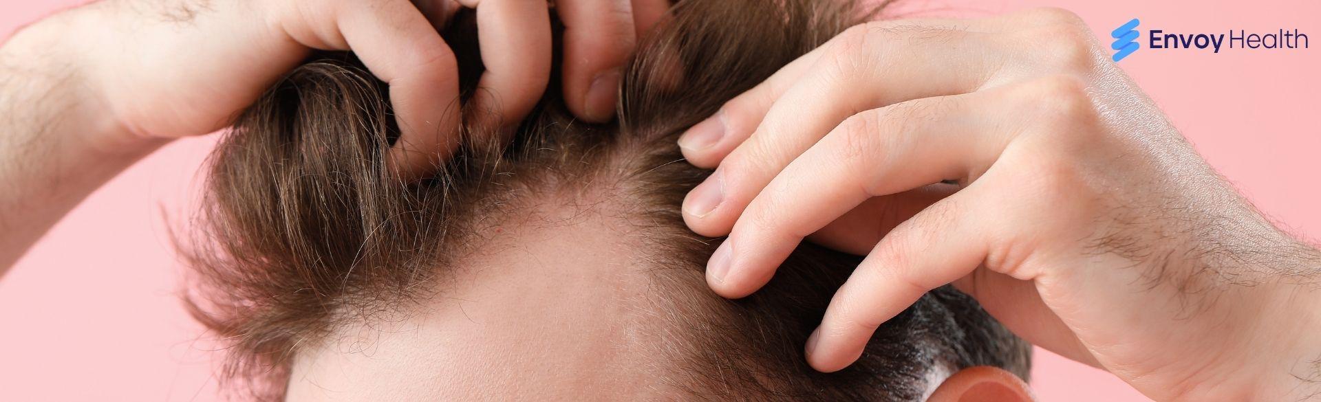 Hair Transplants in Turkey: Pros & Cons Hair Transplants in Turkey: Pros & Cons