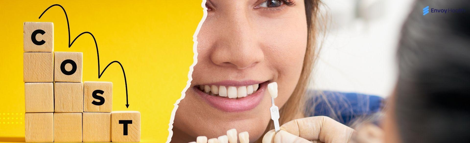 Average Cost of Veneers: A Breakdown of Pricing Factors Average Cost of Veneers: A Breakdown of Pricing Factors