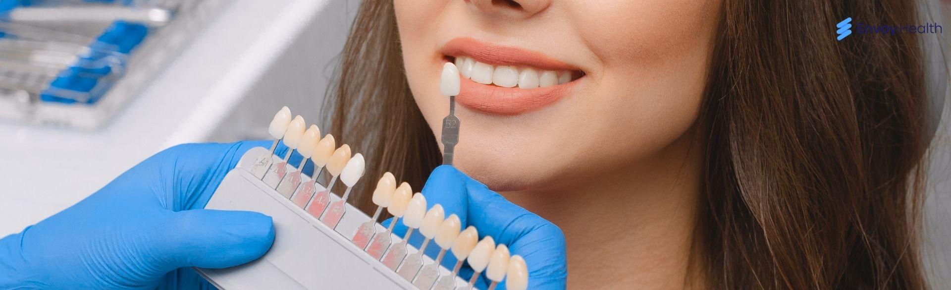 Understanding Porcelain Veneers Cost in Mexico for a Flawless Smile! Understanding Porcelain Veneers Cost in Mexico for a Flawless Smile!