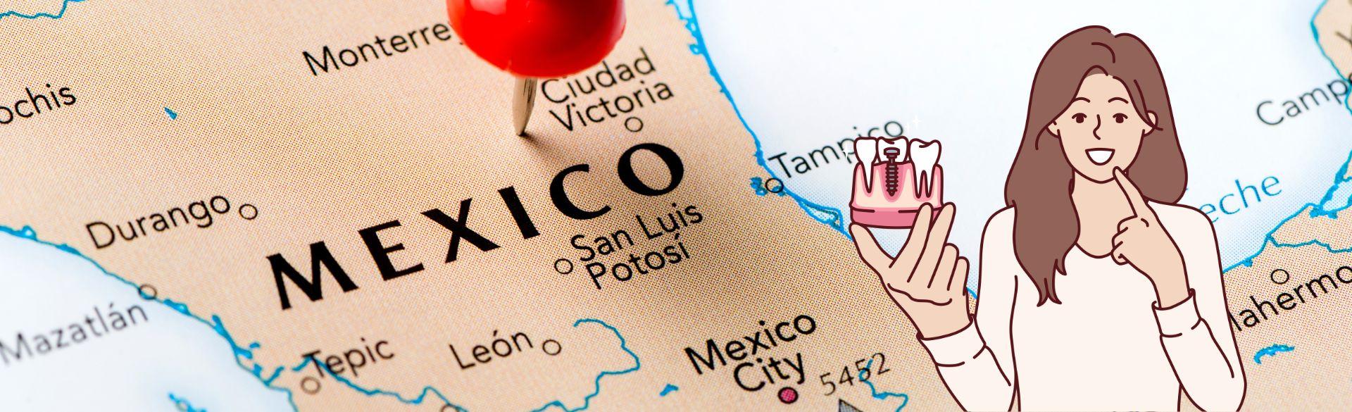 All on 6 dental implants in Mexico All on 6 dental implants in Mexico