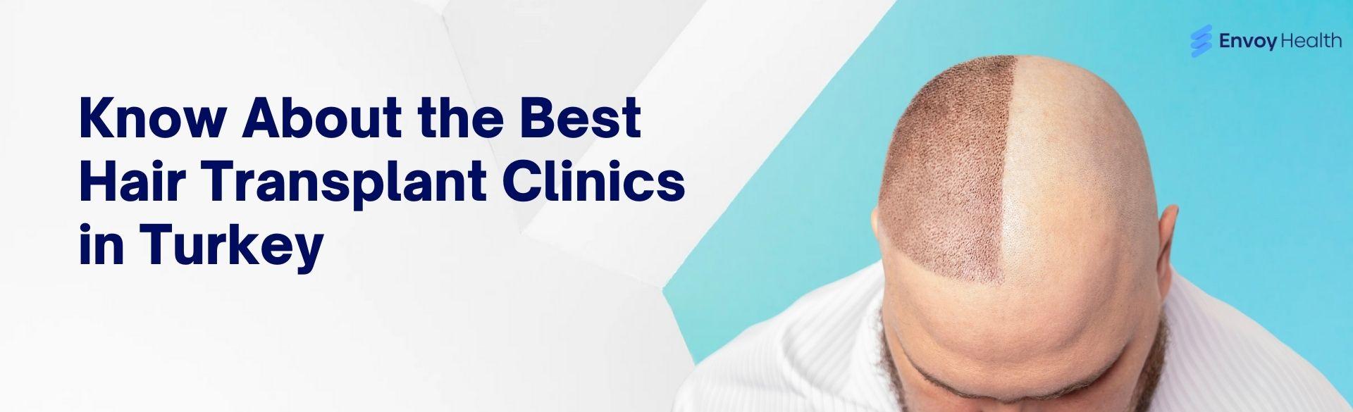Know About the Best Hair Transplant Clinics in Turkey Know About the Best Hair Transplant Clinics in Turkey