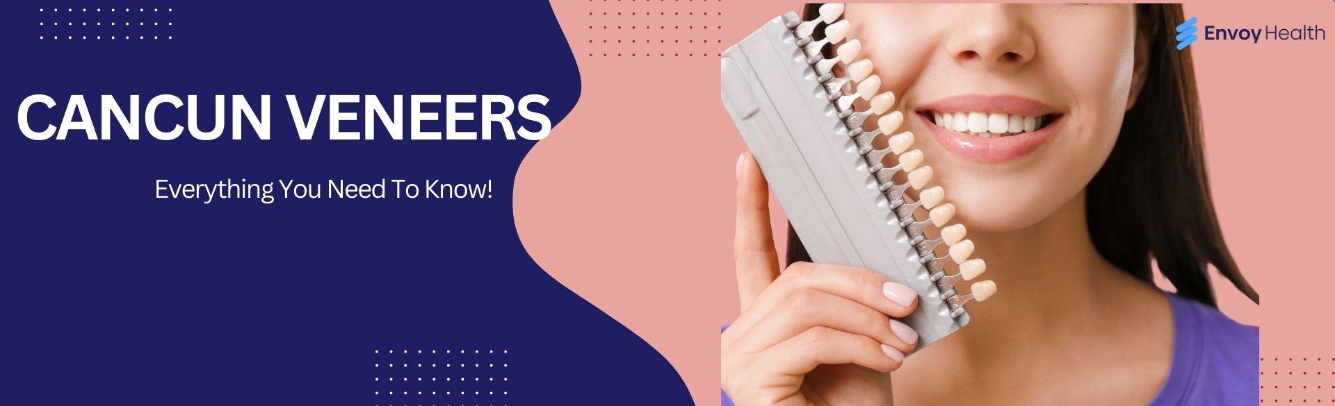 Cancun veneers: Everything You Need To Know Cancun veneers: Everything You Need To Know