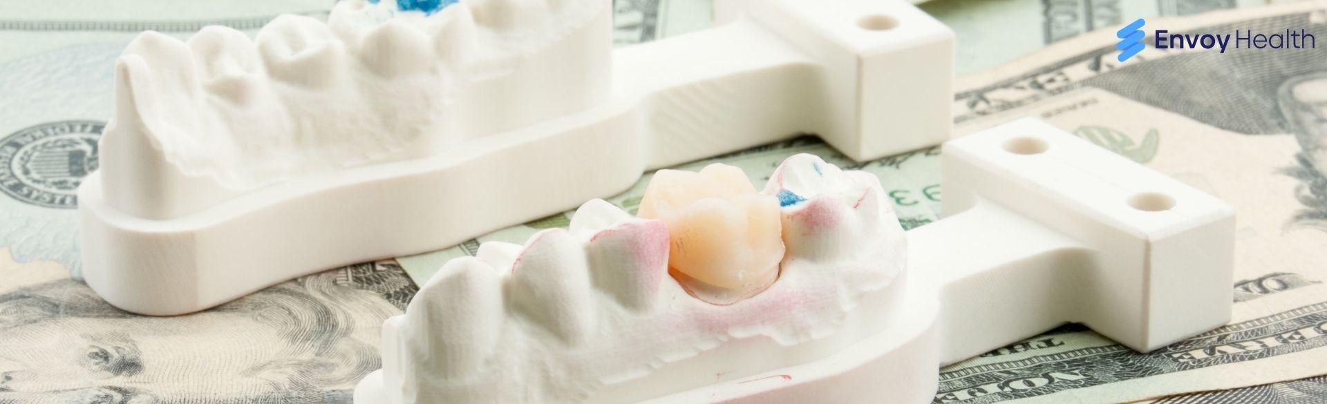Cost for Dental Caps in Los Algodones: What You Need To Know Cost for Dental Caps in Los Algodones: What You Need To Know
