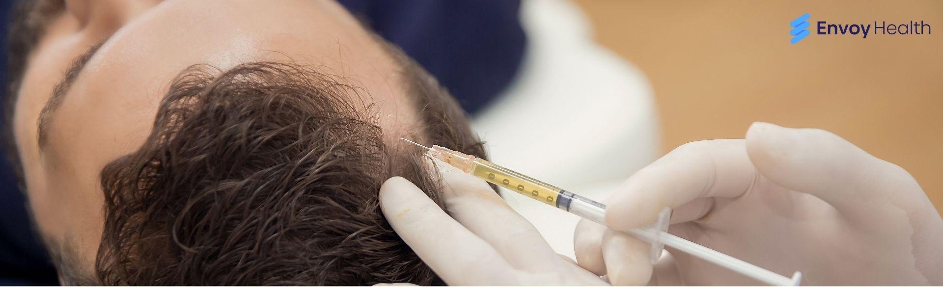 Hair Transplant Turkey: A Complete Guide From Start to Finish Hair Transplant Turkey: A Complete Guide From Start to Finish
