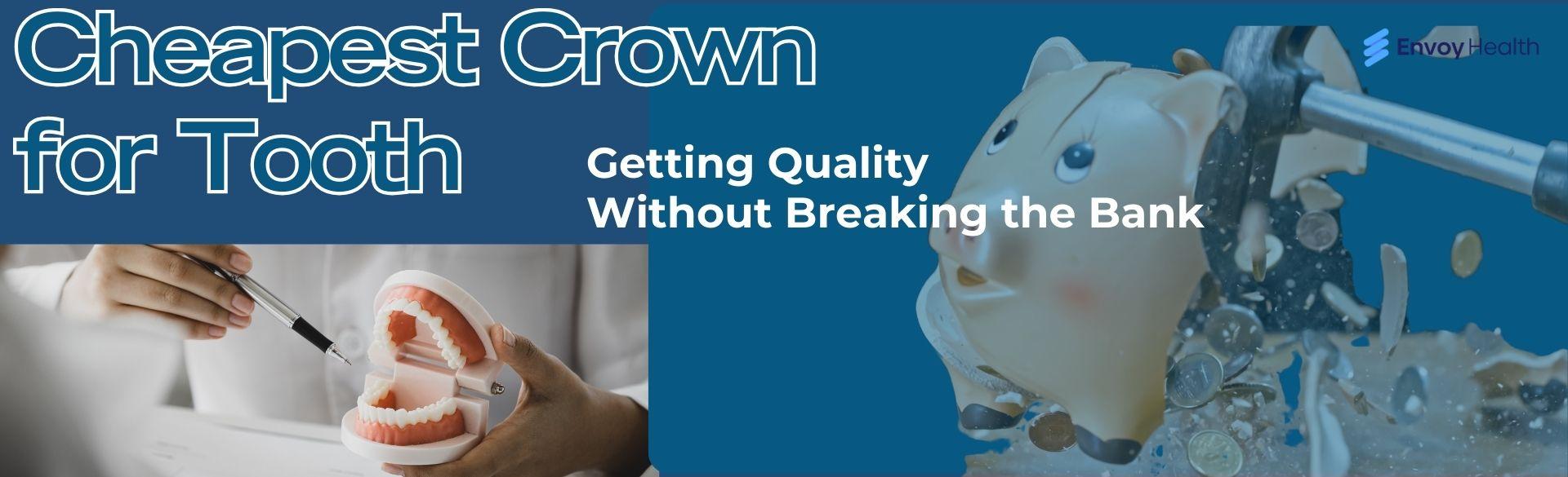 Cheapest Crown for Tooth: Getting Quality Without Breaking the Bank Cheapest Crown for Tooth: Getting Quality Without Breaking the Bank