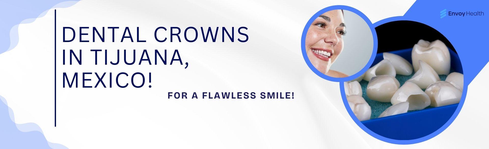 Getting a Flawless Smile with Dental Crowns in Tijuana, Mexico! Getting a Flawless Smile with Dental Crowns in Tijuana, Mexico!