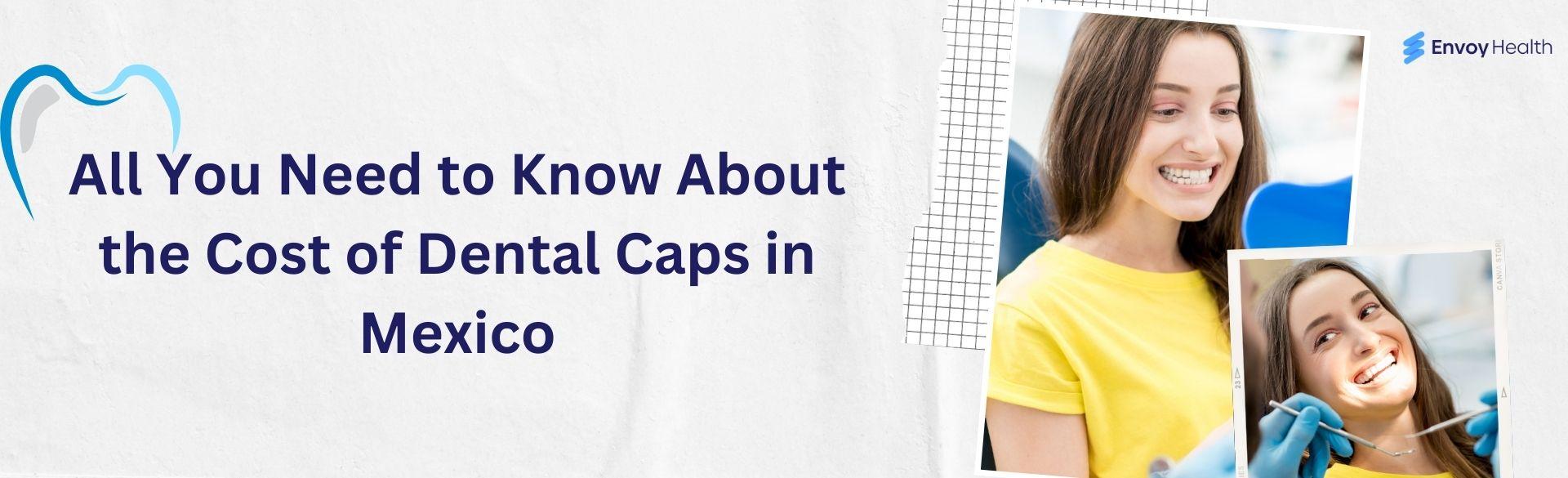All You Need to Know About the Cost of Dental Caps in Mexico All You Need to Know About the Cost of Dental Caps in Mexico