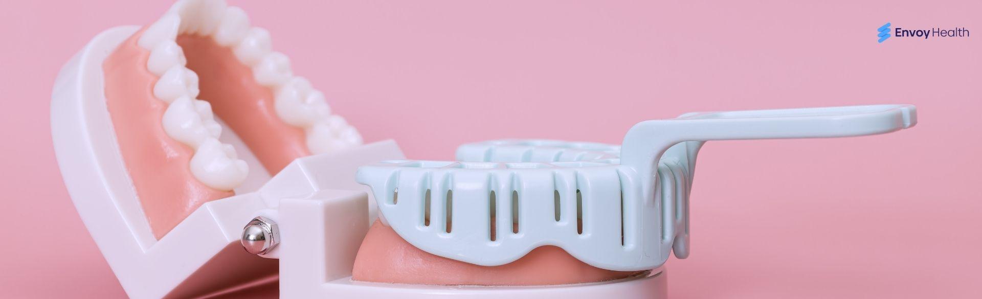 Best diy partial denture kit: is it good or not Best diy partial denture kit: is it good or not