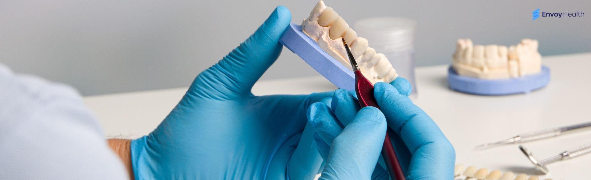 How Long Does a Dental Crown Last? How Long Does a Dental Crown Last?