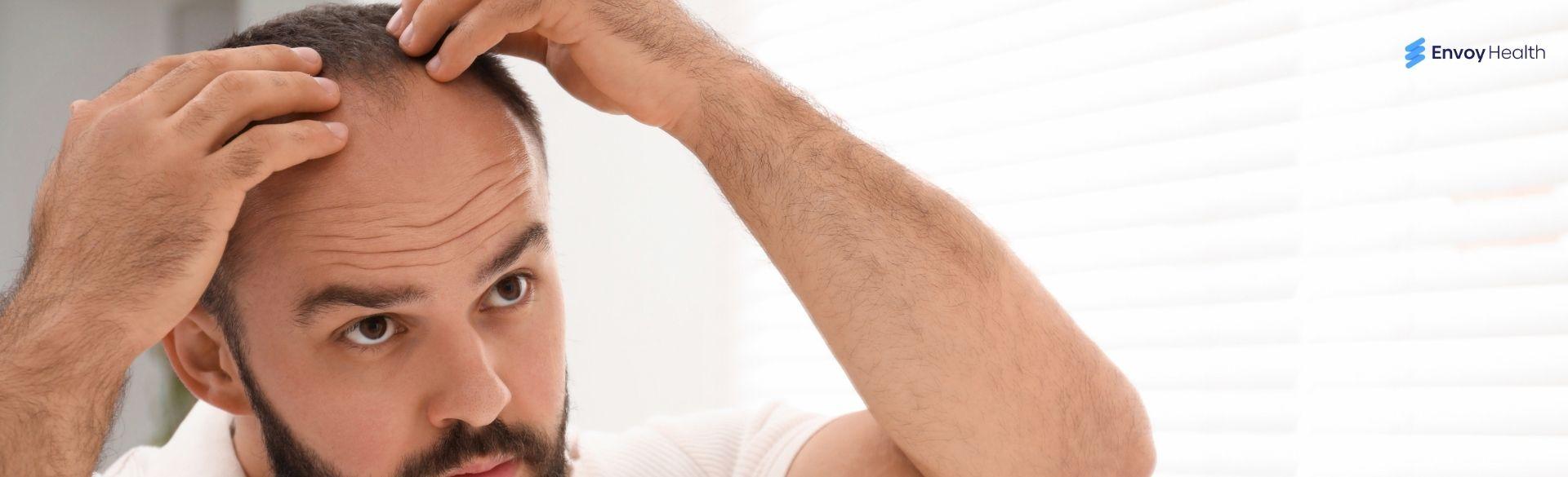 Hairline-Lowering Surgery Hairline-Lowering Surgery