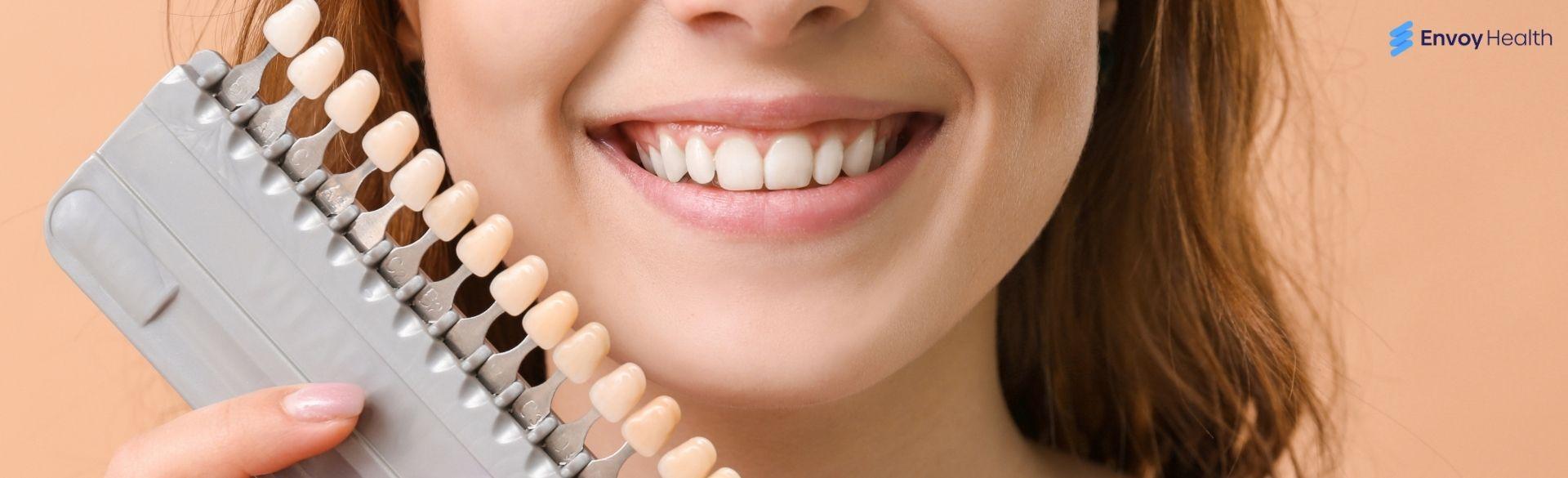 Know the Best Countries To Get Veneers for a Radiant Smile Know the Best Countries To Get Veneers for a Radiant Smile